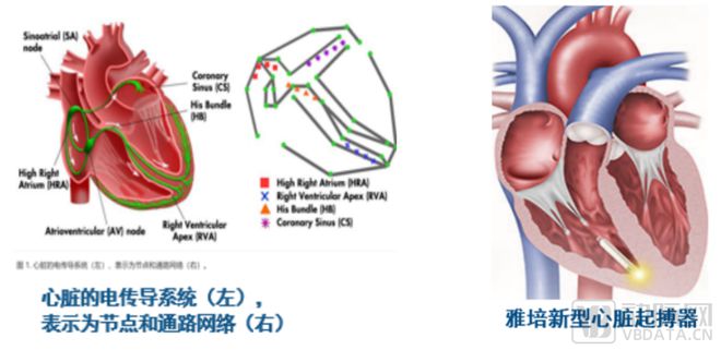 基于模型设计之计算医学：加速心血管医疗设备创新实践【动脉严选公开课】(图1)