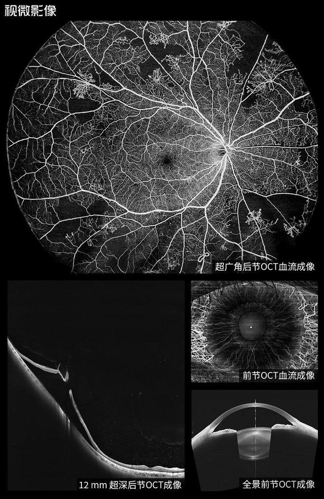 登顶中国眼科学十大进展领跑国产高端眼科设备视微靠什么？(图3)